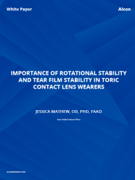 Importance Of Rotational Stability And Tear Film Stability In Toric Contact Lens Wearers